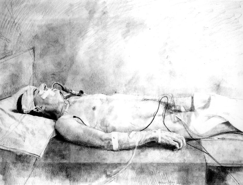 Sick by Antonio López Garcia: History, Analysis & Facts | Arthive
