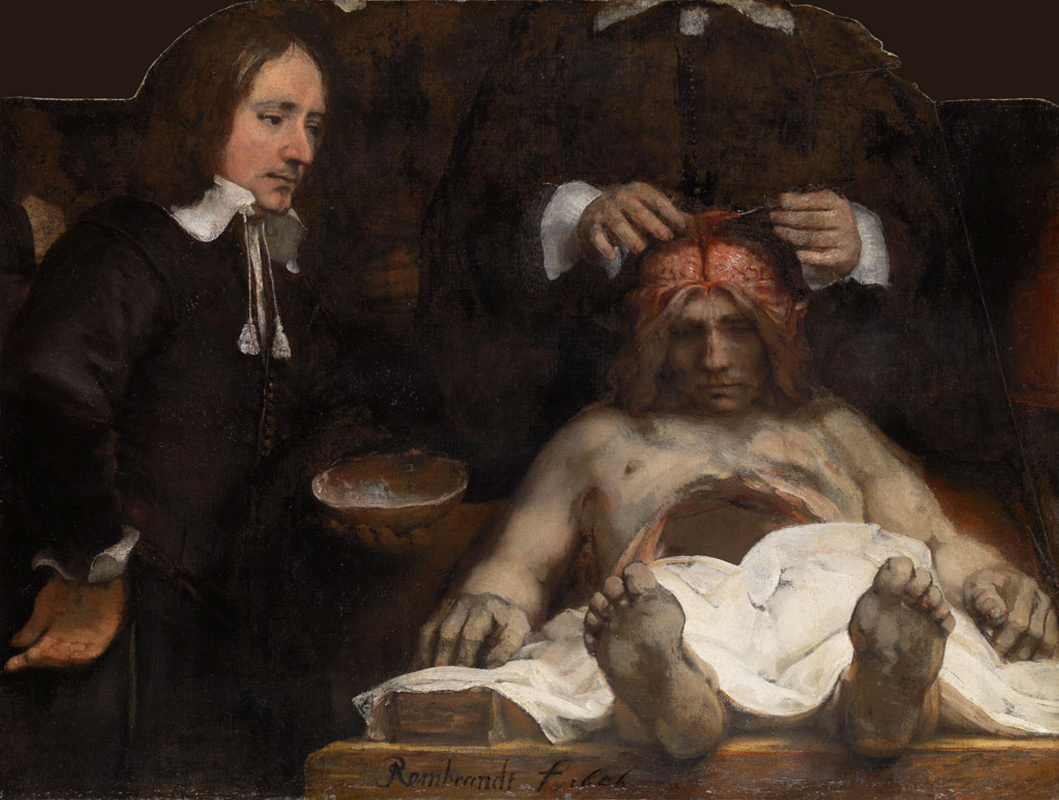 Rembrandt Harmenszoon van Rijn. Lección de anatomía Dr. Deyman.