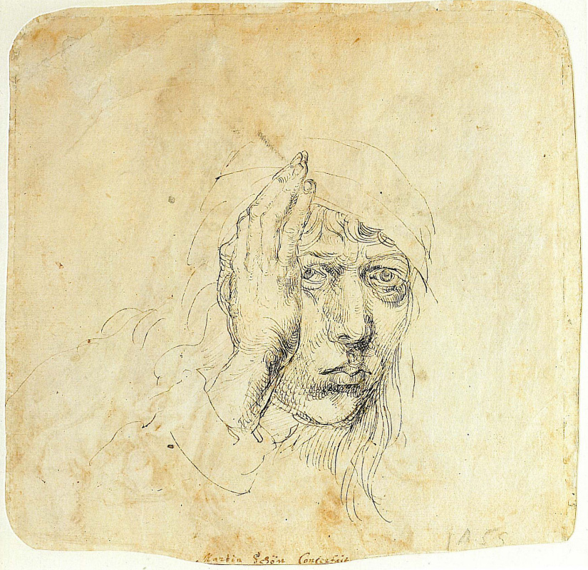 Albrecht Dürer. Self-portrait with a bandage